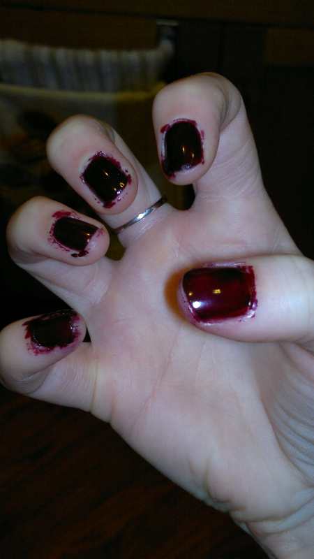 bloody fingernails